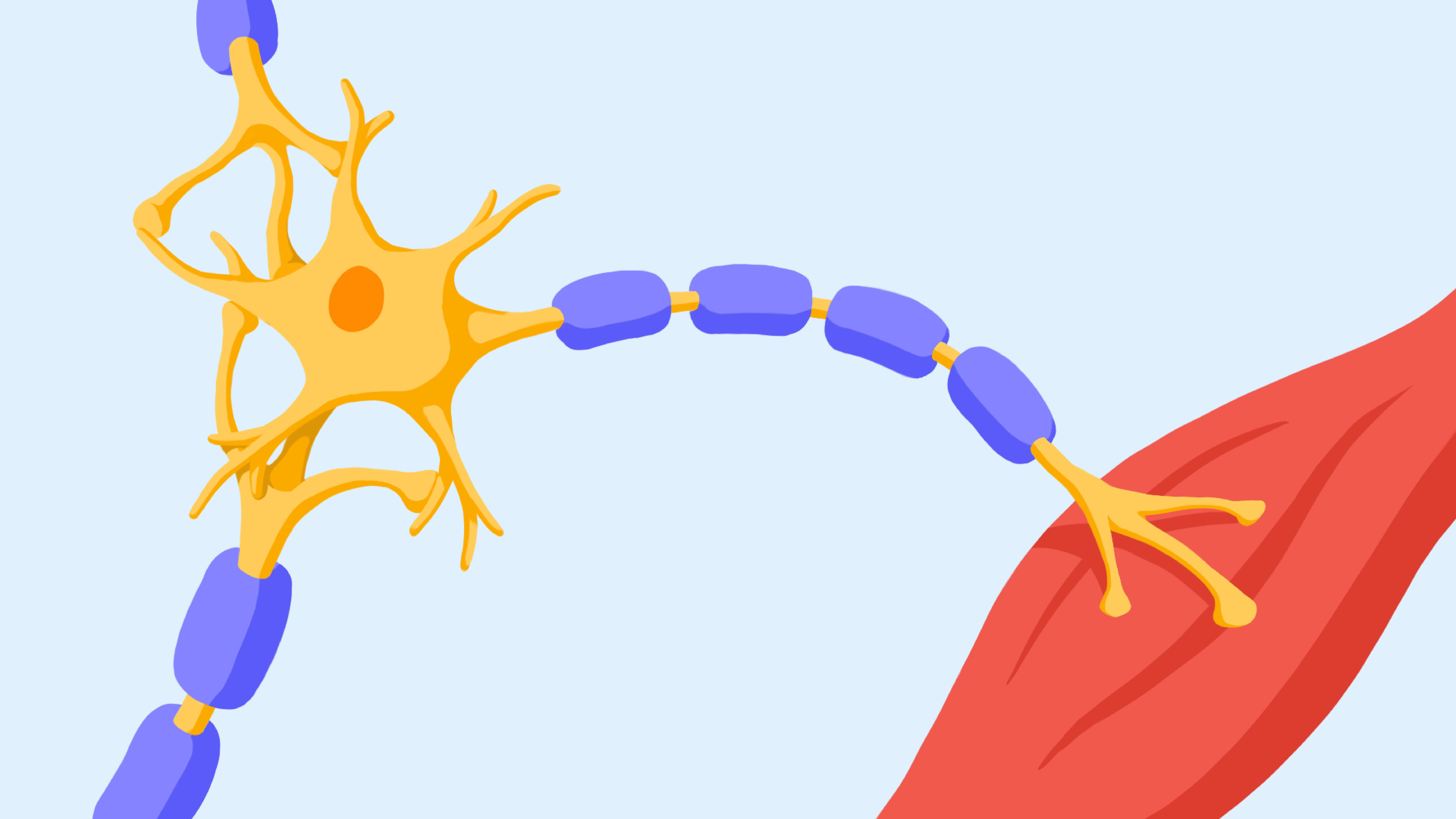 Illustration representing understanding peripheral nerve injury
